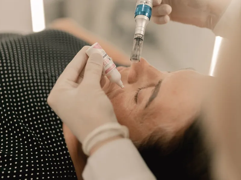 Microneedling — Estetica Beauty & Care