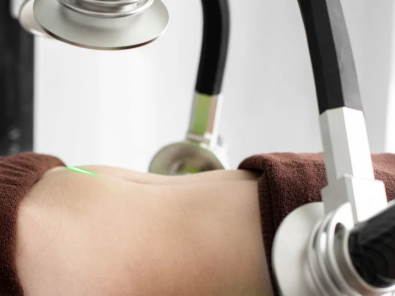 Criolipolisi (Cryo e talasso) — Estetica Beauty & Care